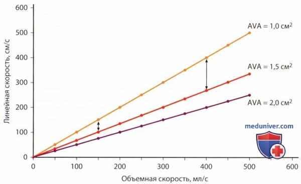 Стресс-ЭхоКГ при аортальном стенозе