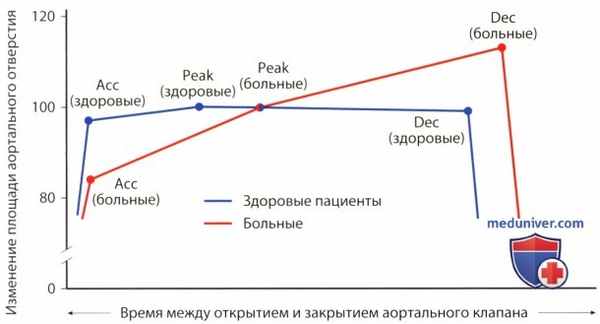 Стресс-ЭхоКГ при аортальном стенозе