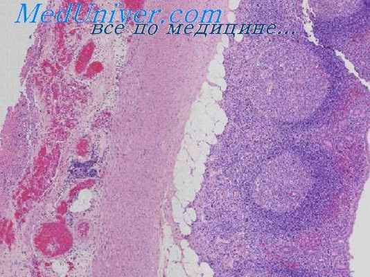 морфология стресса