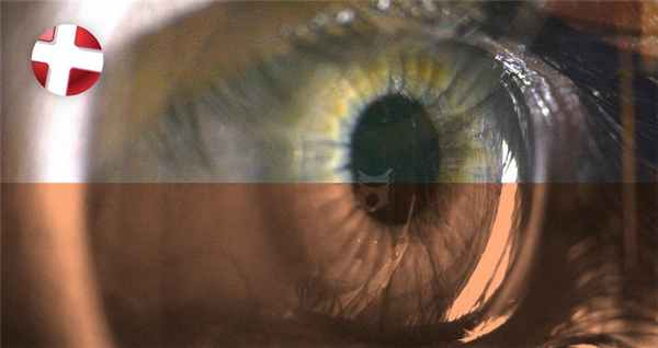 «Кровоизлияние в глаз» (субконъюнктивальное кровоизлияние)