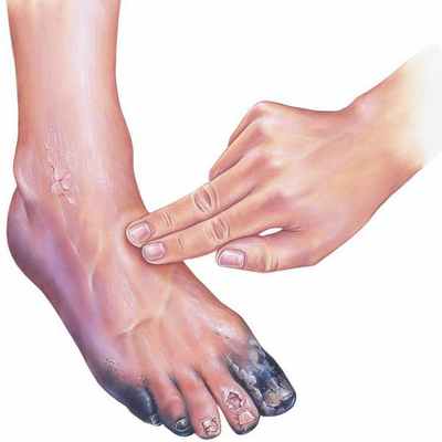 Проверка пульсации артерии