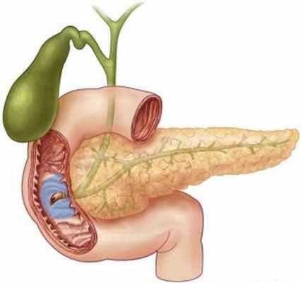 Дуоденит - медцентр 