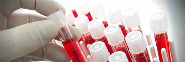 Коагулограмма. Анализ на свертываемость крови