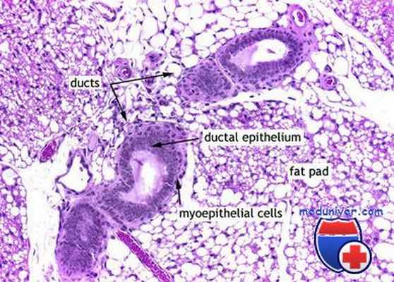 опухоли яичников