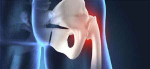 узи тазобедренных суставов