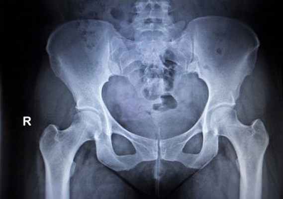 Алгоритм клинического обследования суставов нижних конечностей (тазобедренный сустав)