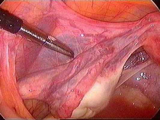 как выглядит патология