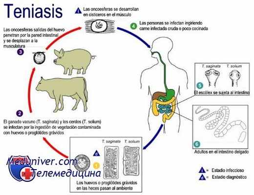 тениоз и цистицеркоз
