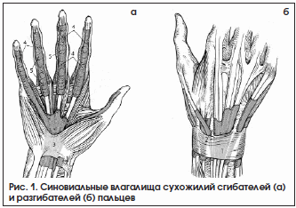 Рис. 1. Синовиальные влагалища сухожилий сгибателей (а) и разгибателей (б) пальцев