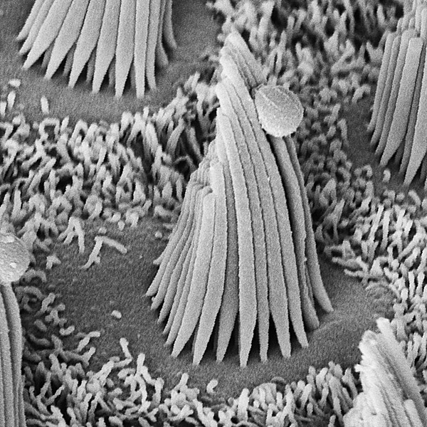 Волосковые клетки под электронным микроскопом