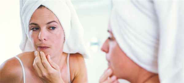 гирсутизм у женщин