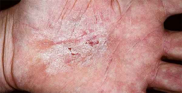 и влияние его