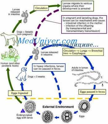 токсокароз глаз