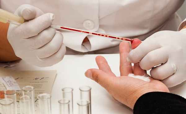 Токсоплазмоз