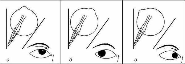 Действие верхней прямой мышцы глаза при различных исходных положениях