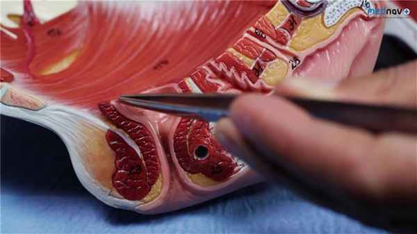 Вид промежности