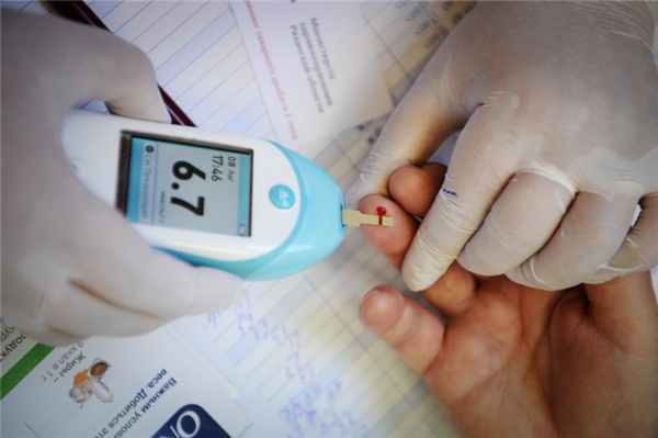 Александр Рюмин / ТАСС