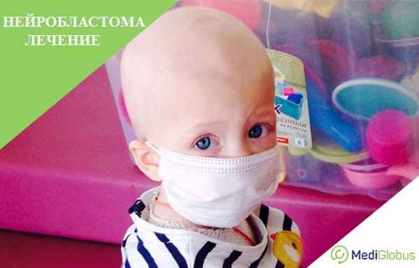 лечение нейробластомы за рубежом
