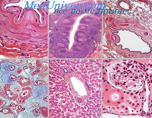 травматические аневризмы