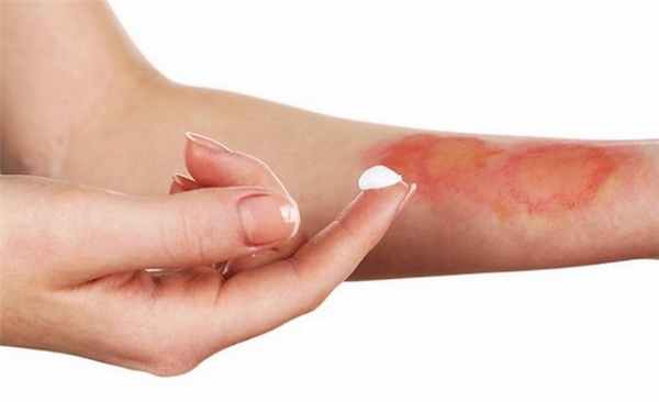 povrezhdeniya-myagkih-tkaney