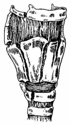 Множественный перелом щитовидного хряща с отрывом большого и малого рожков, подъязычной кости и дуги перстневидного хряща.