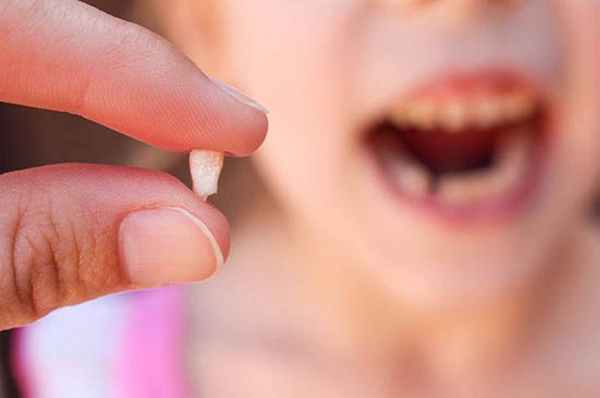 что делать если шатается молочный зуб у ребенка