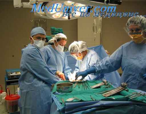 Третичный перитонит. Что такое третичный перитонит?