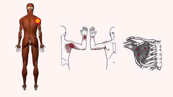 подлопаточная мышца