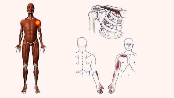 подключичная мышца