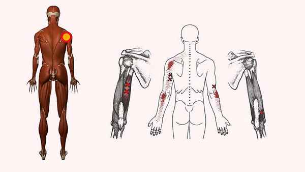 трехглавая мышца плеча