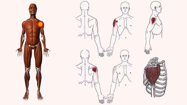 дельтовидная мышца