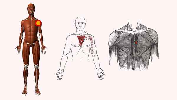 грудинная мышца