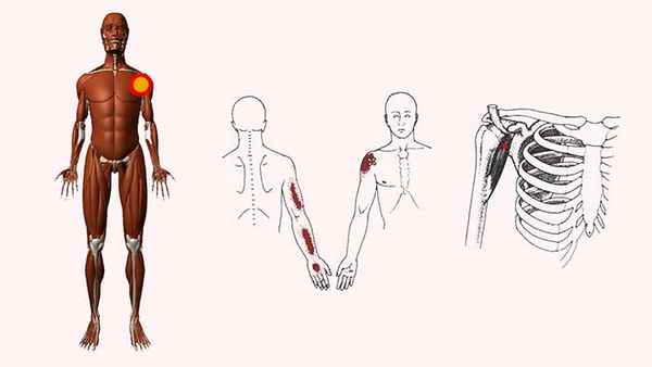 клювовидно плечевая мышца