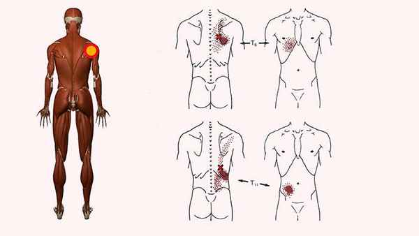 подвздошно рёберная мышца груди