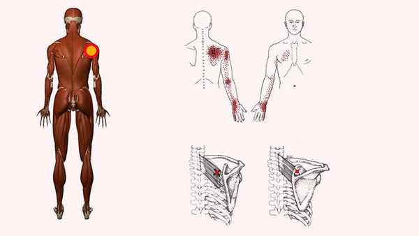 верхняя задняя зубчатая мышца