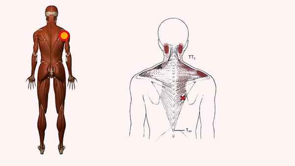 трапециевидная мышца