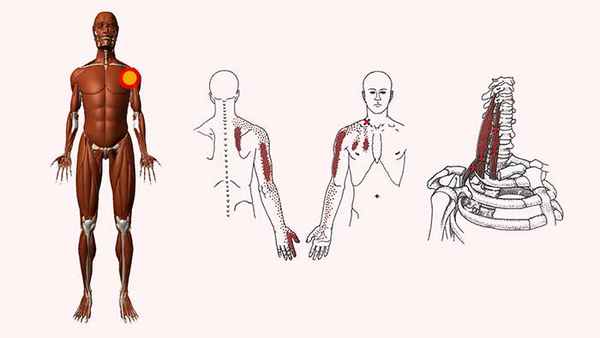 лестничные мышцы