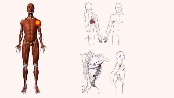 широчайшая мышца спины