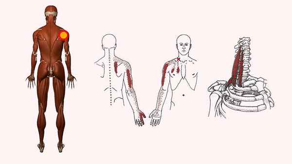 боль на задней поверхности плечевого сустава