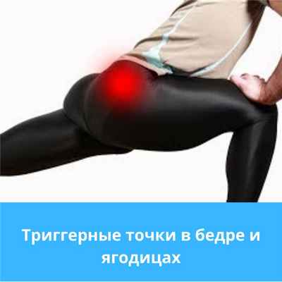 Триггерные точки в бедре и ягодицах: причины и симптомы