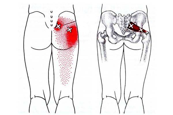 Причины болей в тазобедренном суставе
