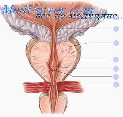 аденома простаты
