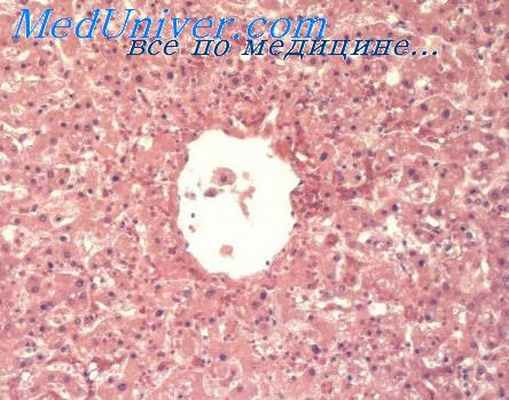 лимфообращение