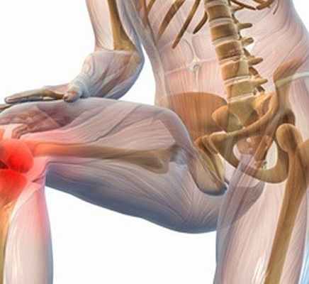 Фото Туберкулез костей и суставов