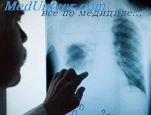 туберкулез лимфоузлов