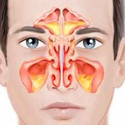 Фото Энцефалитный менингит