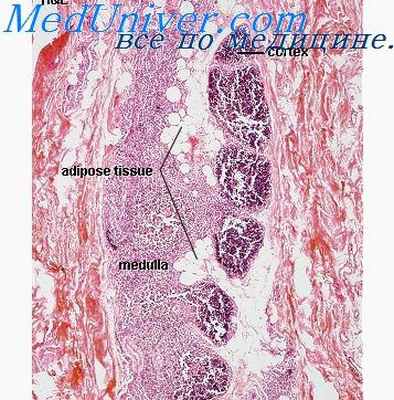 комбинированный иммунодефицит