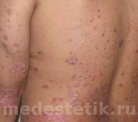 Вы можете заказать Лостерин на Здравсити. Заказать