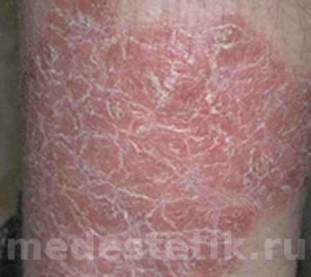 Вы можете заказать Лостерин на Apteka.RU. Самая низкая цена! Бесплатная доставка в вашем городе в ближайшую аптеку! Заказать