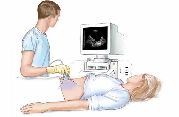 Как подготовиться к УЗИ брюшной полости?